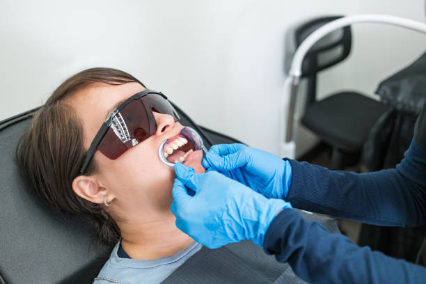 Best Knocked-Out Tooth (Avulsed Tooth) Treatment in Collins, MS